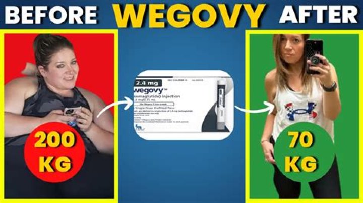 	Liz Hurley claims Shane Warne’s new face is result of weight loss	