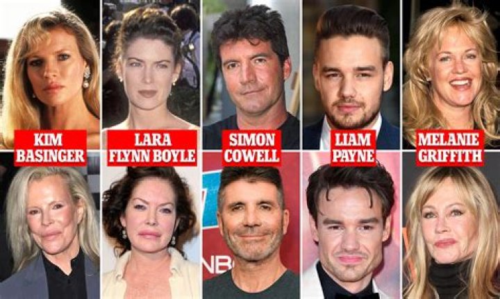 What celebrities have had a stroke?