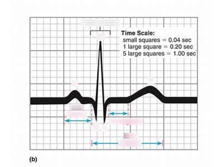 What does an ECG measure quizlet?