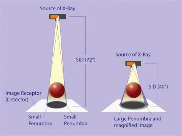 What is source to image distance?