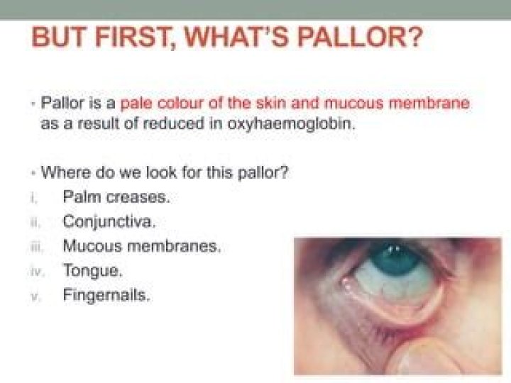 Where do you find pallor?