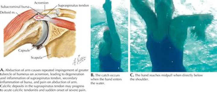 
Who Are Alice Tai Parents Angela Tai And Steve Tai? What Happened To The Swimmer’s Leg? 